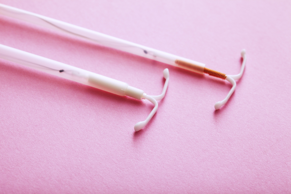 What’s It Like to Get an IUD?