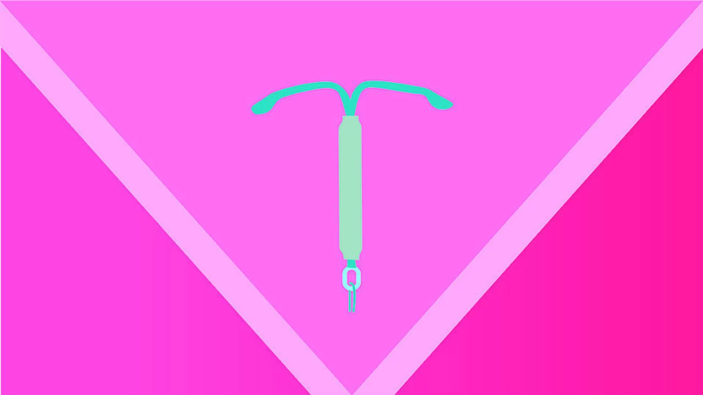 What Are My IUD Options?